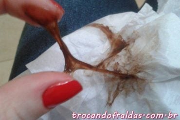 Por que meu sangue da menstruação está preto? - ISTOÉ Independente