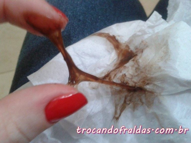 Menstruação Marrom - O Que É A Menstruação Borra De Café?
