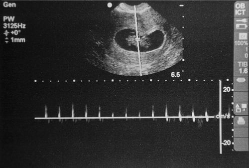 Ultrassom - emergências em ginecologia e obstetrícia